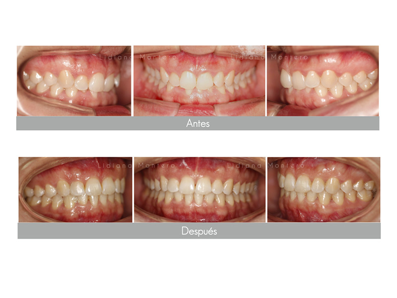 ortodoncia dental