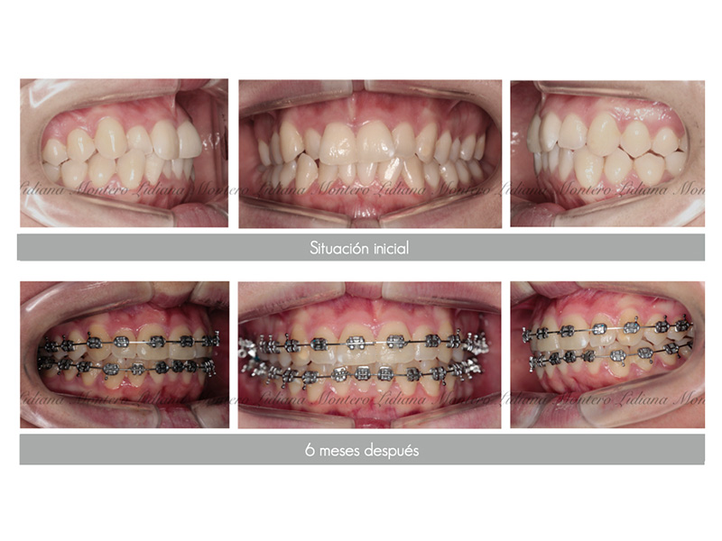 ortodoncia dental