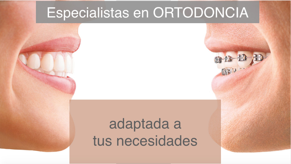 ortodoncia Alcoy